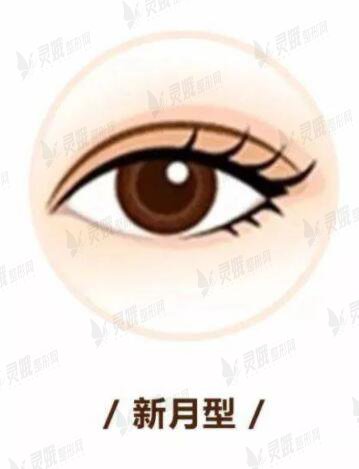 新月形双眼皮