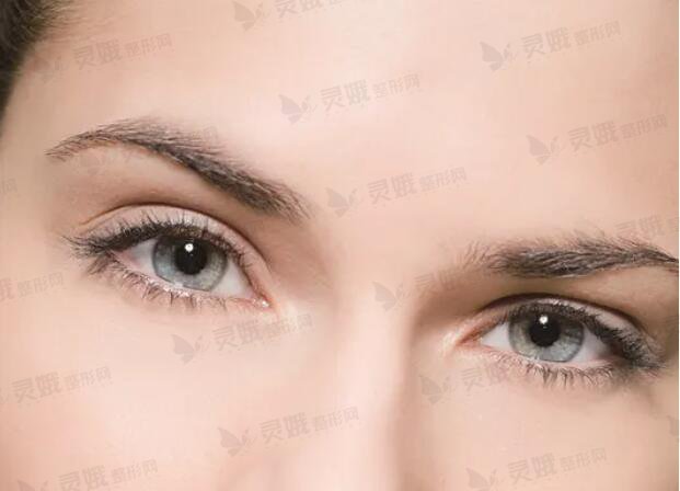 高颧骨的欧洲双眼皮“混血儿”脸