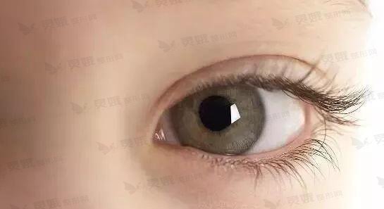 哪种眼型适合做欧式眼