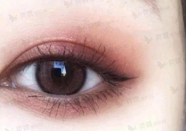 扇形双眼皮鹅蛋脸