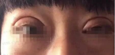 失败故事二