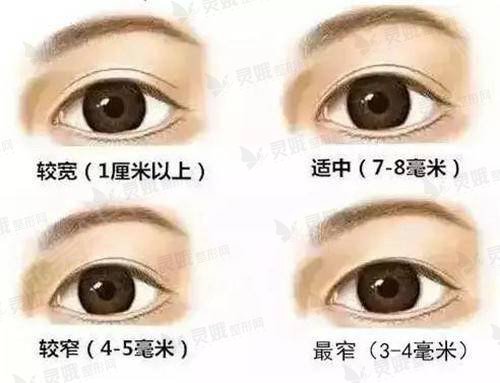 双眼皮多宽比较合适?