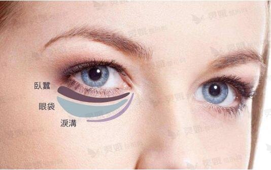 9个去眼袋的小妙招