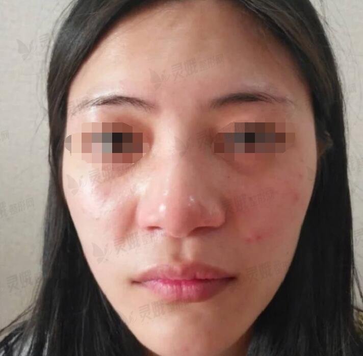 陈辉医生鼻部手术前