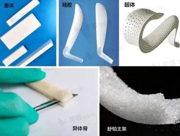 隆鼻假体