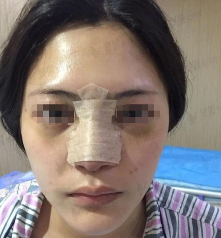 手术实施期间