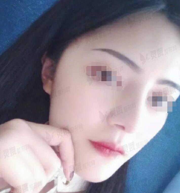 术后恢复期间