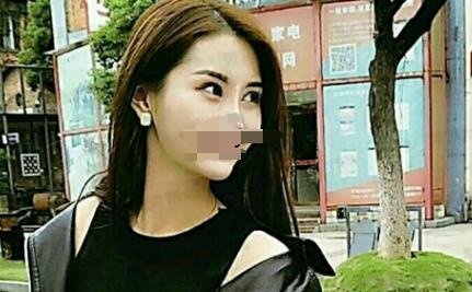 双眼皮8毫米恢复果图