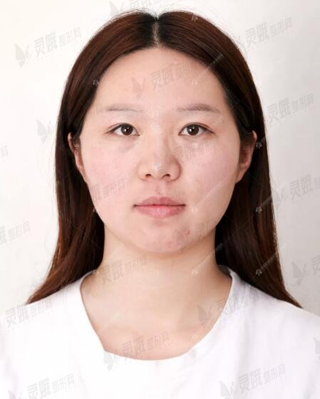 真人纹嘴唇15天图片