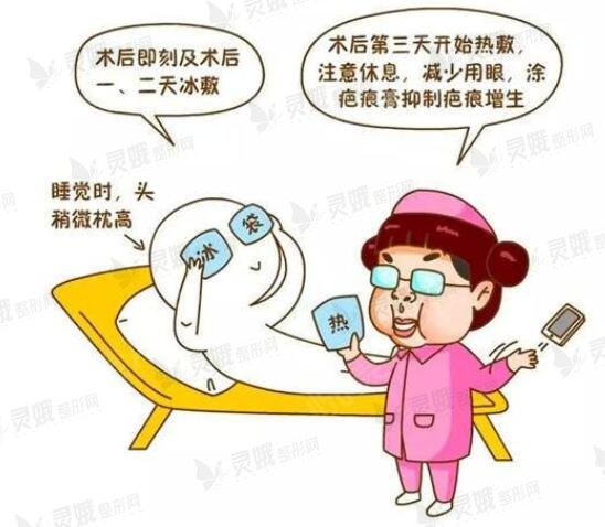 双眼皮术后的护理要点