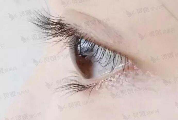护理要点