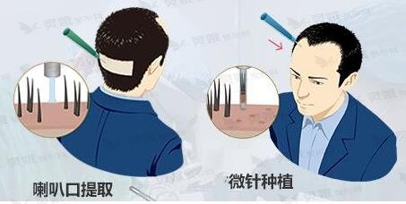 八个方法让头发变浓密