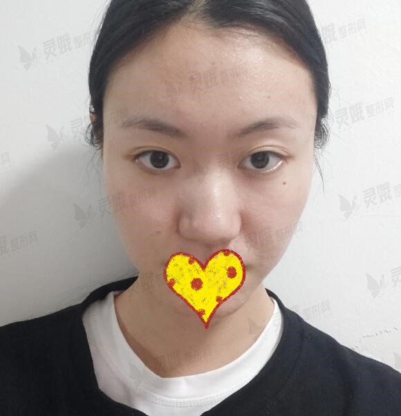 手术之前前