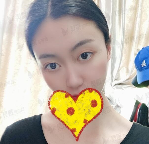 手术之后