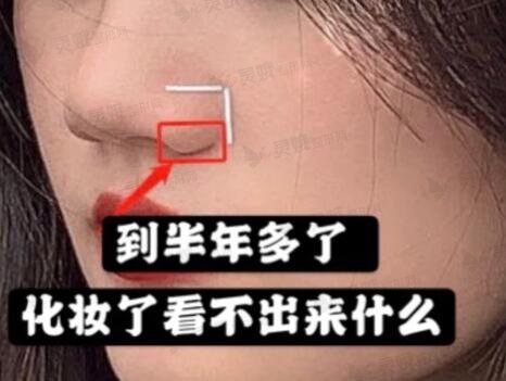 杭州117医院整形科后
