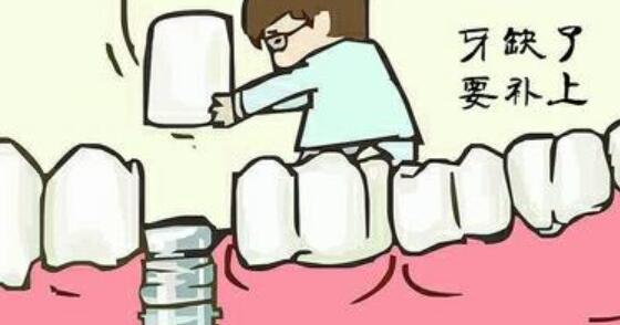 l种植牙w01.jpg