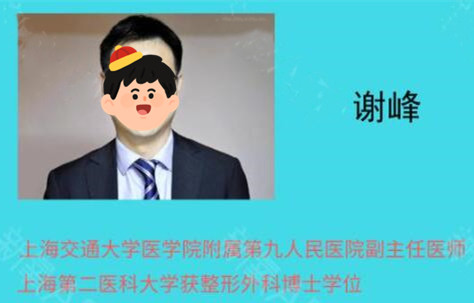 上海九院谢峰割双眼皮风格自然吗？医生个人信息+双眼皮术后反馈